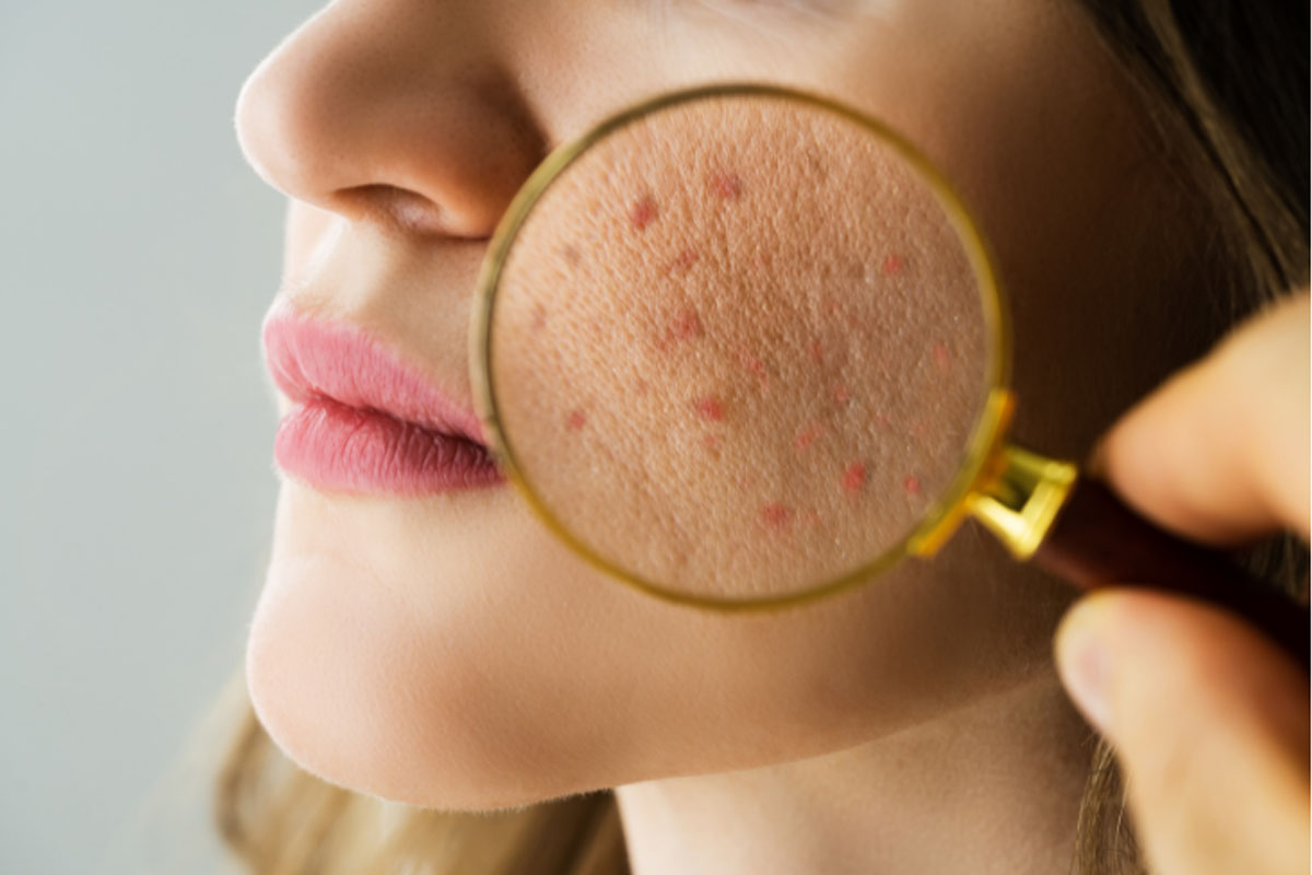 Dermatology Department