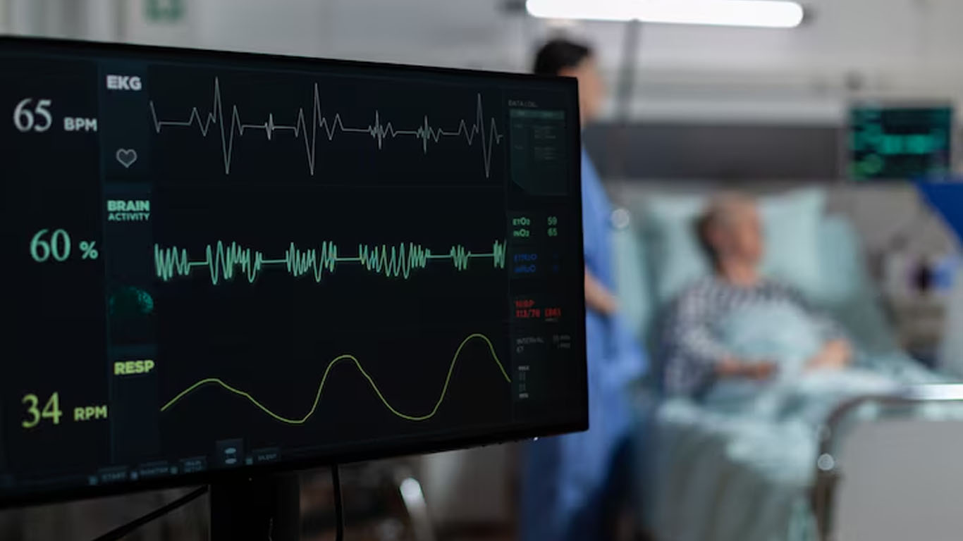 ECG Test