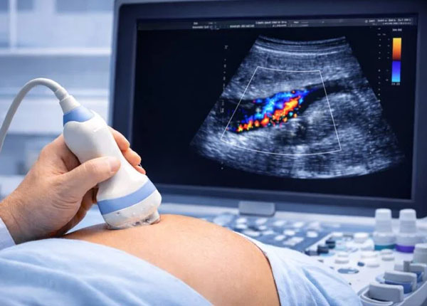 Ultrasound Scan